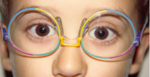 montura mal adaptada gafas para niños 2