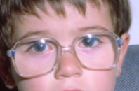 Tres ejemplos de monturas inadecuadas para niños 