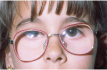 Tres ejemplos de monturas inadecuadas para niños 