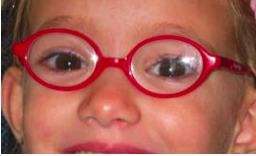 gafas para niños oftalmologia barcelona