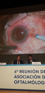 Un gran congreso para la Clínica García de Oteyza congreso españa oftalmologia