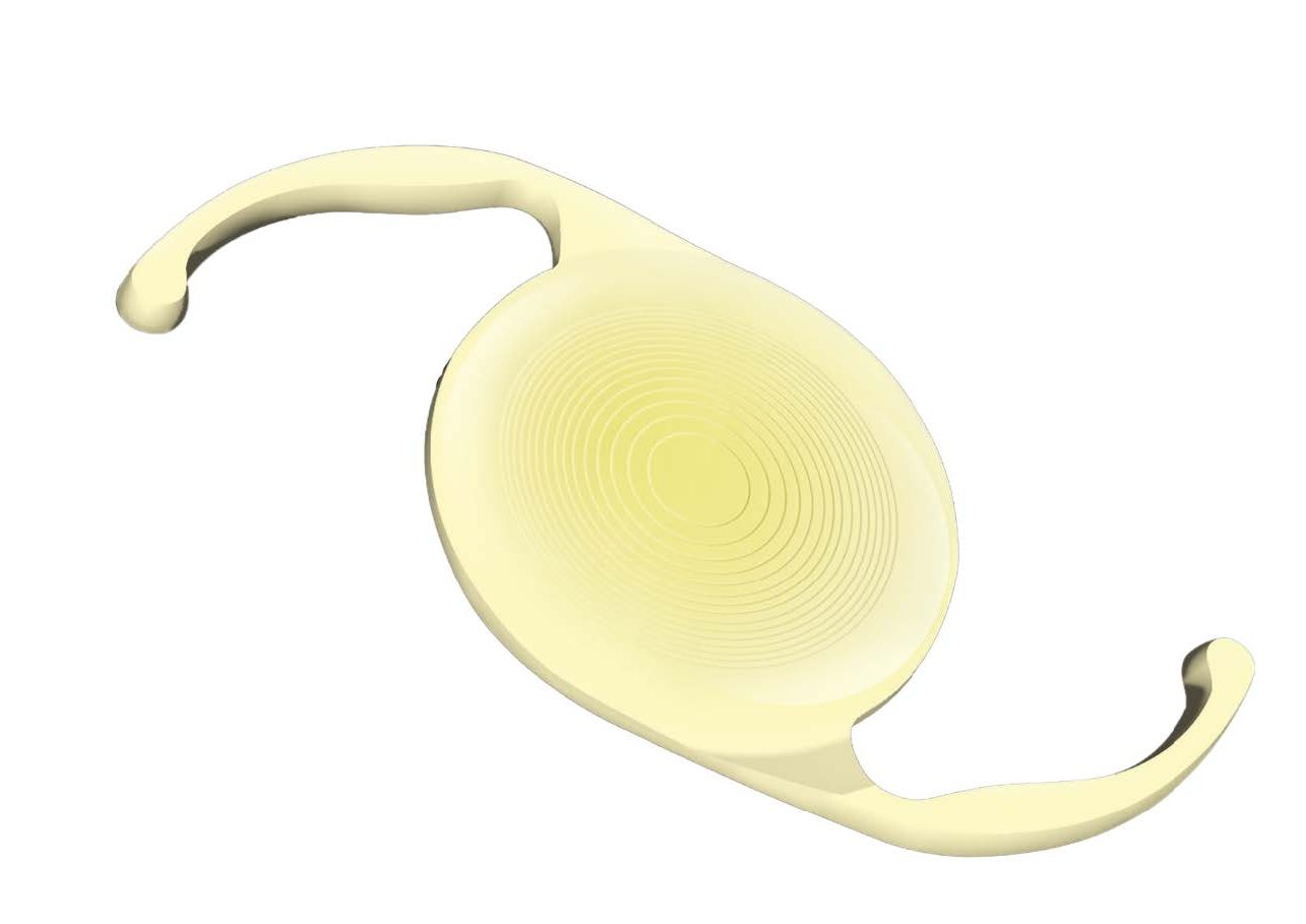 Defectos que se pueden corregir con las lentes intraoculares