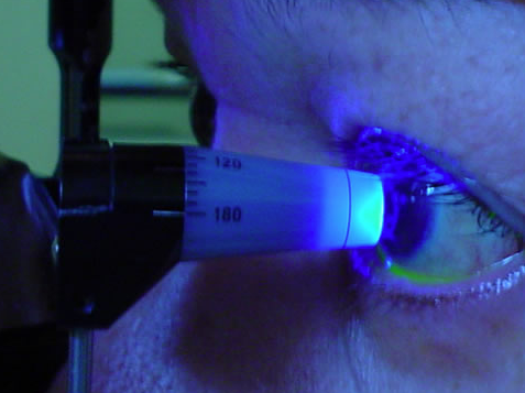 La toma de la presión intraocular es una de las pruebas más importantes para el diagnóstico de hipertensión ocular