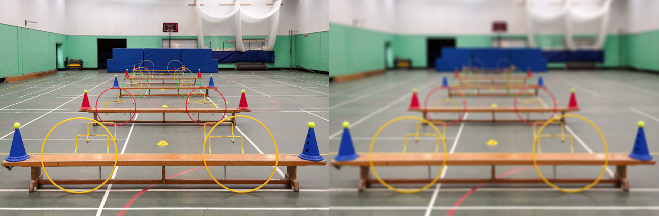 Visión de un paciente sin defecto de graduación a la derecha y con dos dioptrías de miopía a la izquierda.